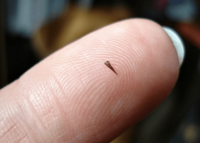 How to remove a splinter from your finger - Fastlyheal